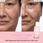skin care