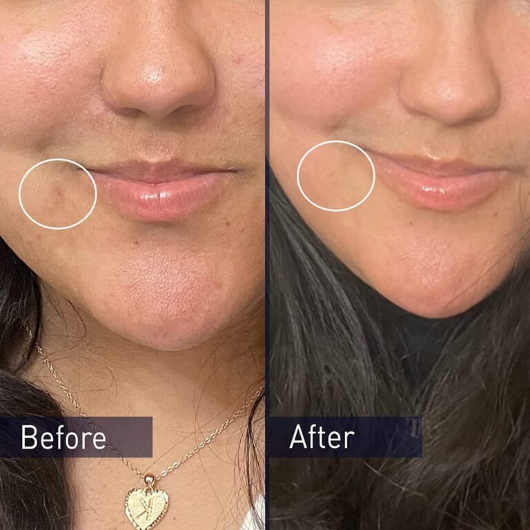 skin care