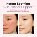 skin care