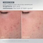 skin care