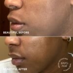 skin care